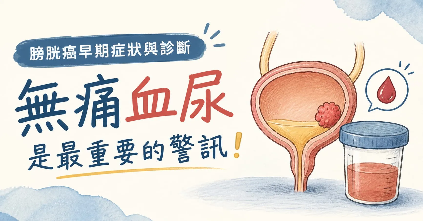 膀胱癌早期症狀與診斷｜無痛血尿是最重要的警訊