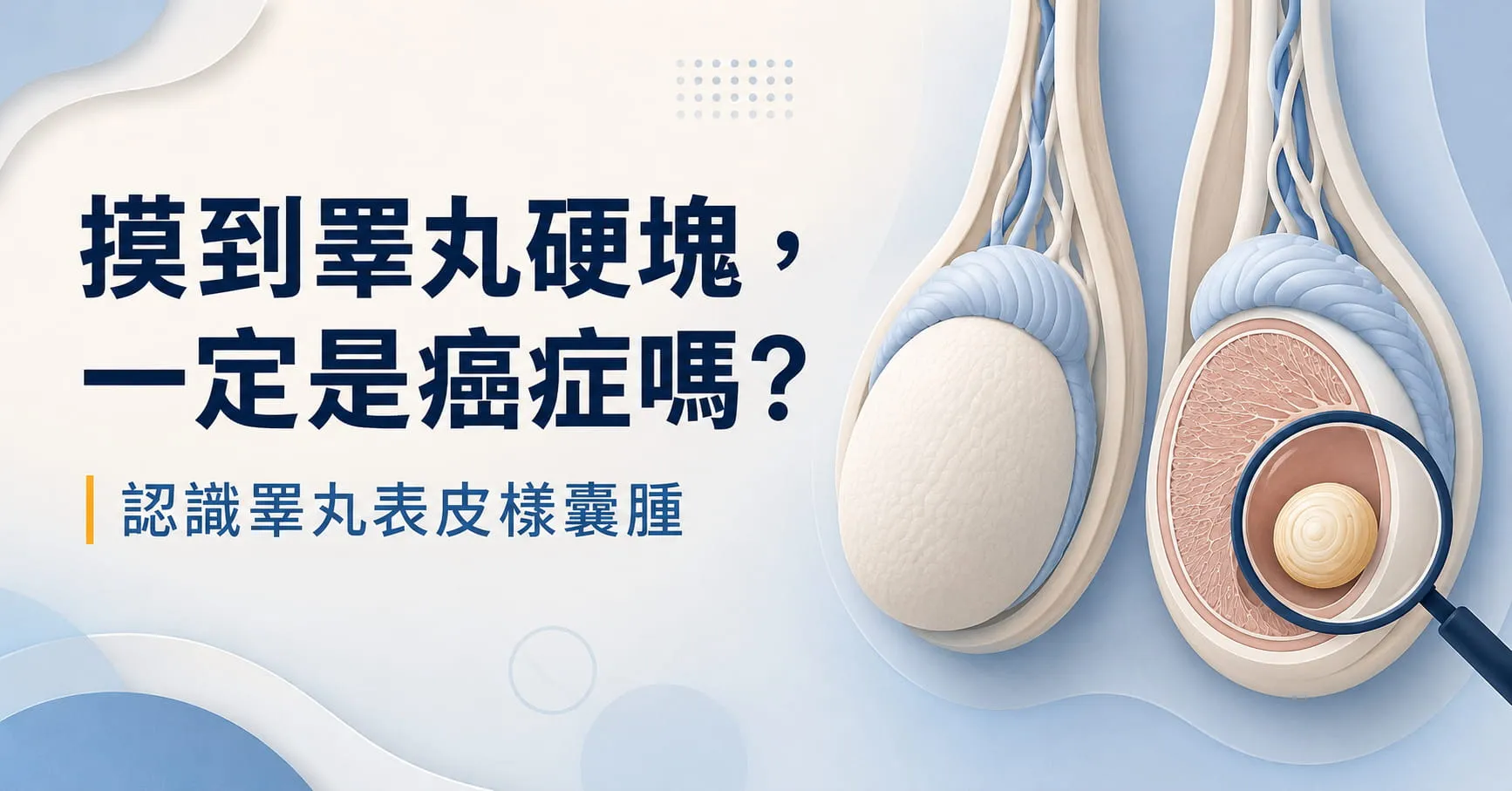 睪丸表皮樣囊腫是什麼？摸到睪丸硬塊一定是癌症嗎？