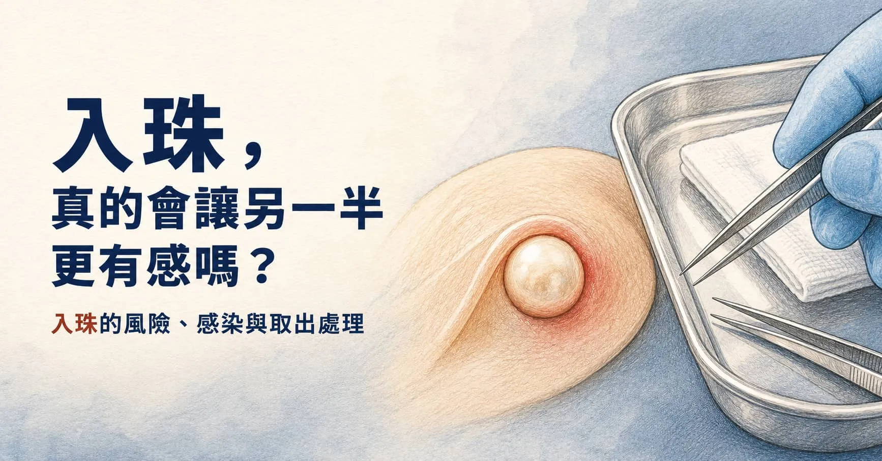 入珠真的會讓另一半更有感嗎？陰莖入珠的風險、感染與取出處理
